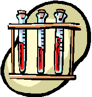 Chemistry Beakers